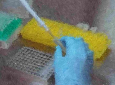 PCR検査は非特異的反影響が出る